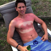 Apparently Sunburn Art Is Going To Be All the Rage At Your Fourth Of July Party This Weekend